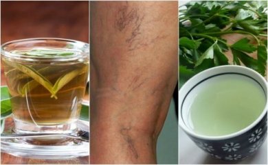 5 tisane diuretiche per combattere le vene varicose