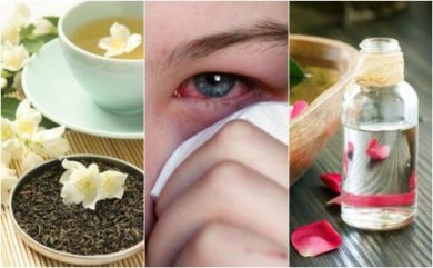 Infezioni oculari: i 5 migliori rimedi naturali