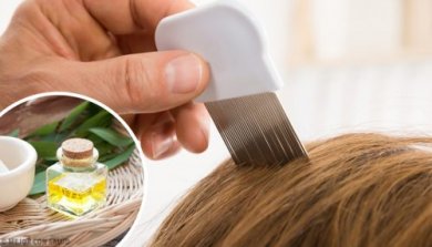 Eliminare i pidocchi con i prodotti naturali