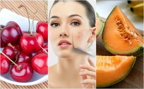 Alimenti per una pelle priva di impurità Alimenti per una pelle priva di impurità