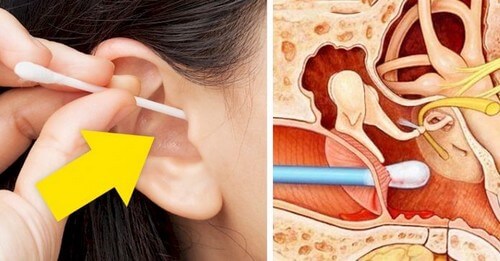 Cerume per le orecchie