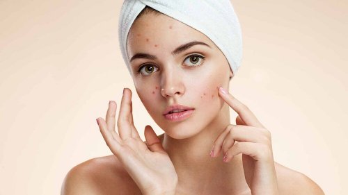 Segreti di bellezza con l'aceto di mele per l'acne