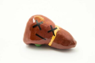 Cause e sintomi dell'insufficienza epatica