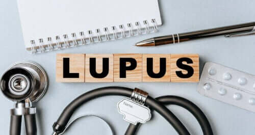 Lupus eritematoso sistemico.