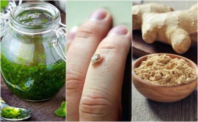 5 rimedi naturali per eliminare le verruche