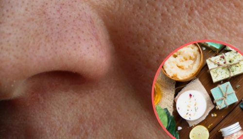 8 rimedi naturali per restringere i pori dilatati 8 rimedi naturali per restringere i pori dilatati