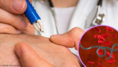 Cause, sintomi e diagnosi della malattia di Lyme