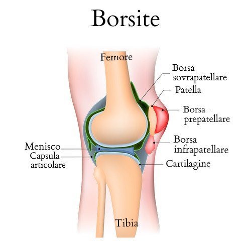 Schema della borsite