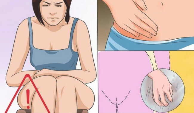 Candidosi vaginale: cause, sintomi e trattamento Candidosi vaginale: cause, sintomi e trattamento
