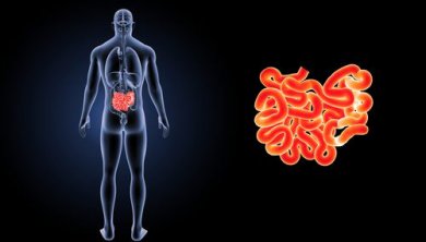 Cos'è e come si cura un'ernia inguinale?