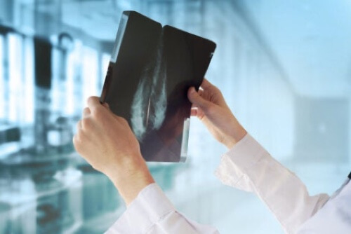 Diagnosi del tumore alla mammella