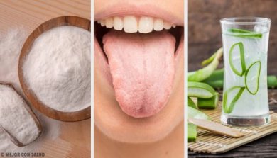 Lingua bianca addio grazie a 8 rimedi naturali