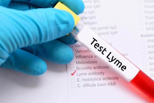 Test di Lyme