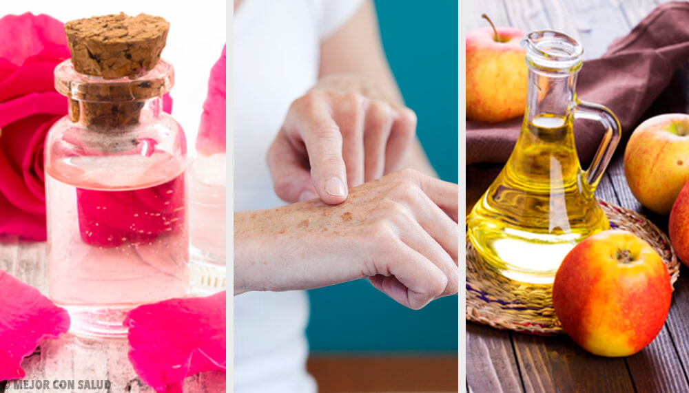 Schiarire le mani: 8 trattamenti naturali Schiarire le mani: 8 trattamenti naturali