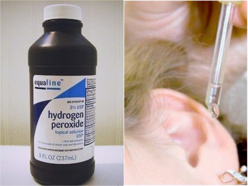 Perossido di idrogeno per far uscire acqua dalle orecchie.