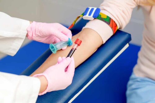 Eccesso di vitamina d nel sangue