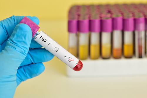 Analisi ebv