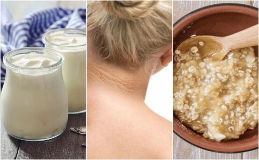 Eliminare le macchie scure sul collo con rimedi naturali Eliminare le macchie scure sul collo con rimedi naturali