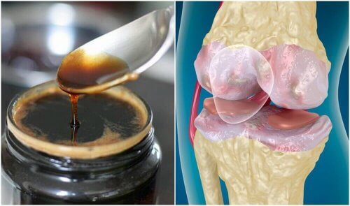 Rafforzare ossa e articolazioni: consigli e trattamento