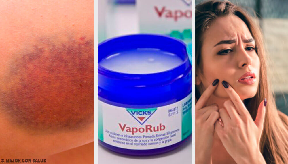 Vicks VapoRub: 11 interessanti usi alternativi Vicks VapoRub: 11 interessanti usi alternativi