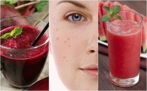 Acne sul viso: combatterla con 5 frullati detox