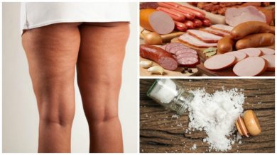 Combattere la cellulite: 7 alimenti da evitare