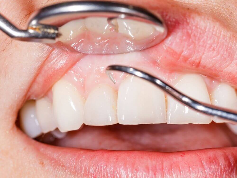 Controllo della bocca dal dentista