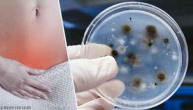 Infezioni vaginali: come riconoscere tipi e cause