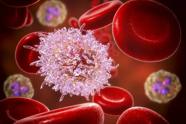 leucemia-cellule-pilociti