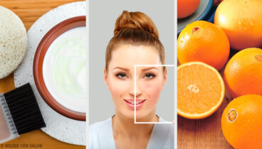 Eliminare le macchie della pelle con metodi naturali