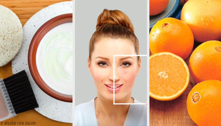 Eliminare le macchie della pelle con metodi naturali