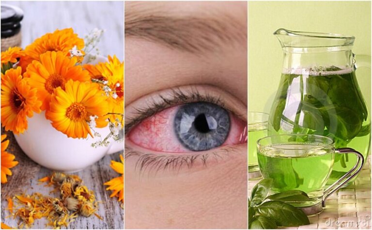 Alleviare la congiuntivite: i migliori rimedi naturali