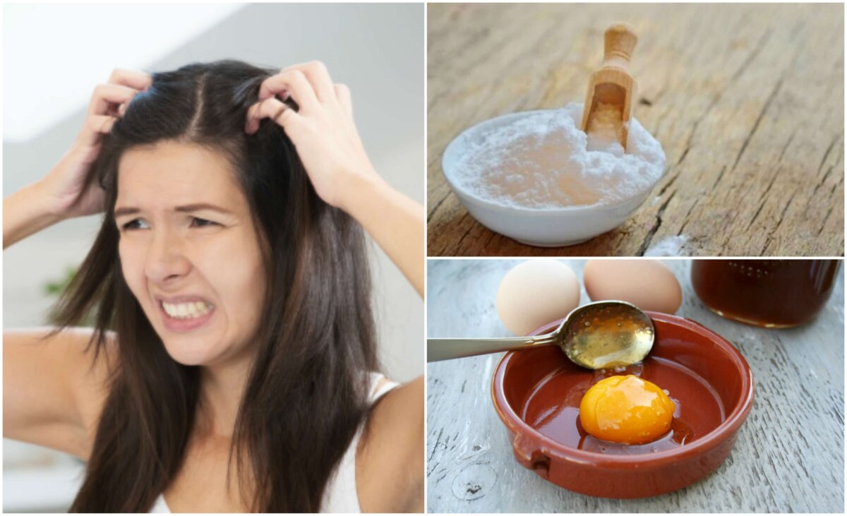 Ragazza con mani nei capelli e rimedi naturali per eliminare la forfora