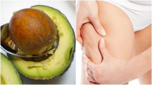 Seme di avocado per combattere la cellulite