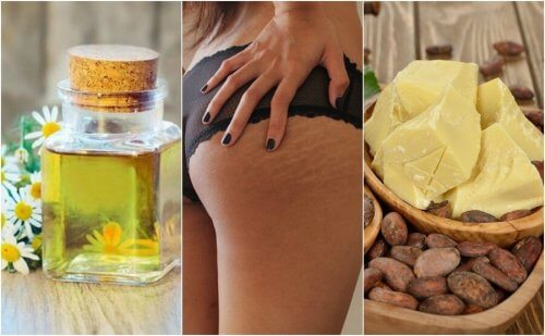 Ridurre le smagliature con rimedi fai-da-te