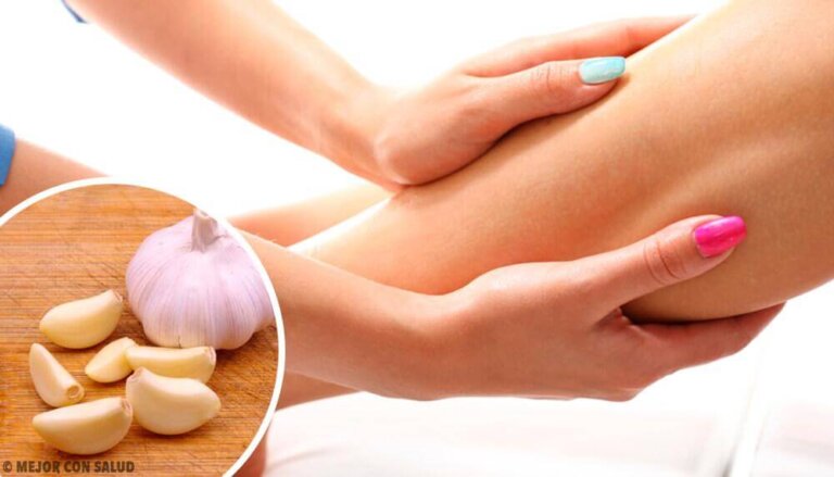 Alleviare un edema: rimedi naturali