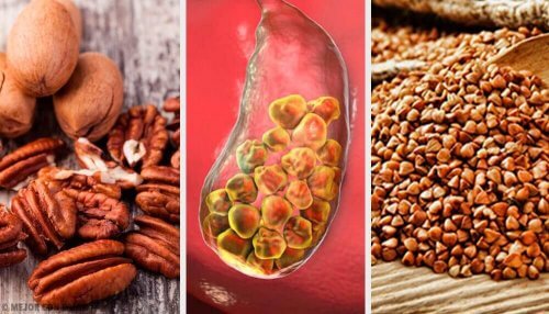 6 alimenti per contrastare i calcoli biliari