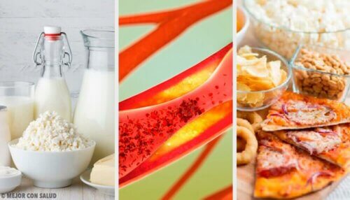 Alimenti che provocano l'ostruzione delle arterie