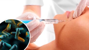 Tossina botulinica: un veleno letale