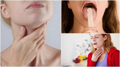 Tumore alla gola: sintomi iniziali da non ignorare