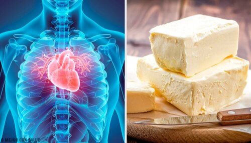 margarina e cibi che danneggiano il cuore