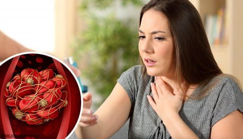 Coaguli di sangue: campanelli d'allarme