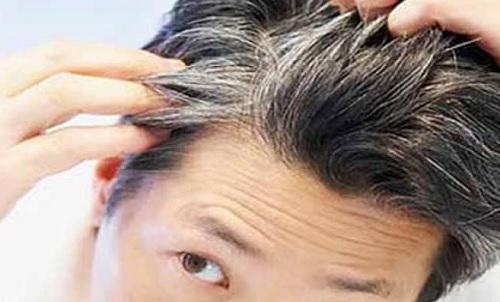 Comparsa prematura dei capelli bianchi: consigli