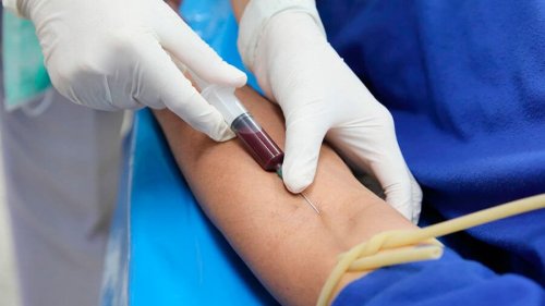 Prelievo del sangue
