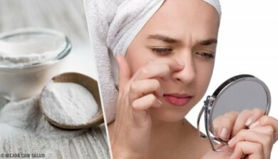 Eliminare i punti neri con 4 maschere al bicarbonato di sodio