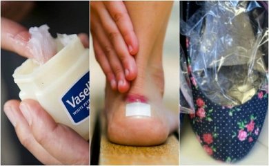 Escoriazioni da scarpe: soluzioni naturali