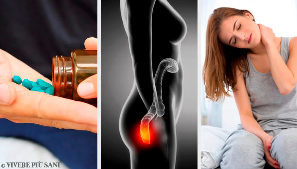 Colite: consigli per prevenirla e trattarla Colite: consigli per prevenirla e trattarla