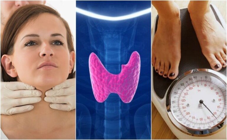 Riconoscere l'ipotiroidismo: 10 sintomi