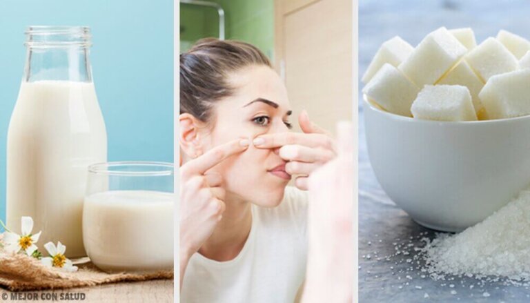 Eliminare le impurità della pelle: 4 maschere