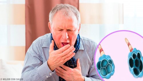 Malattia polmonare ostruttiva cronica (COPD)